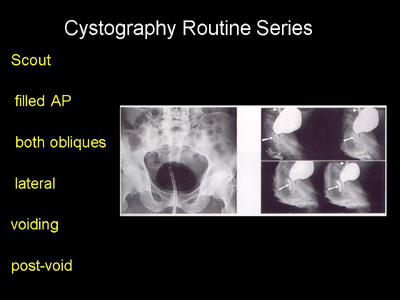 Scout   filled AP   both obliques   lateral  voiding